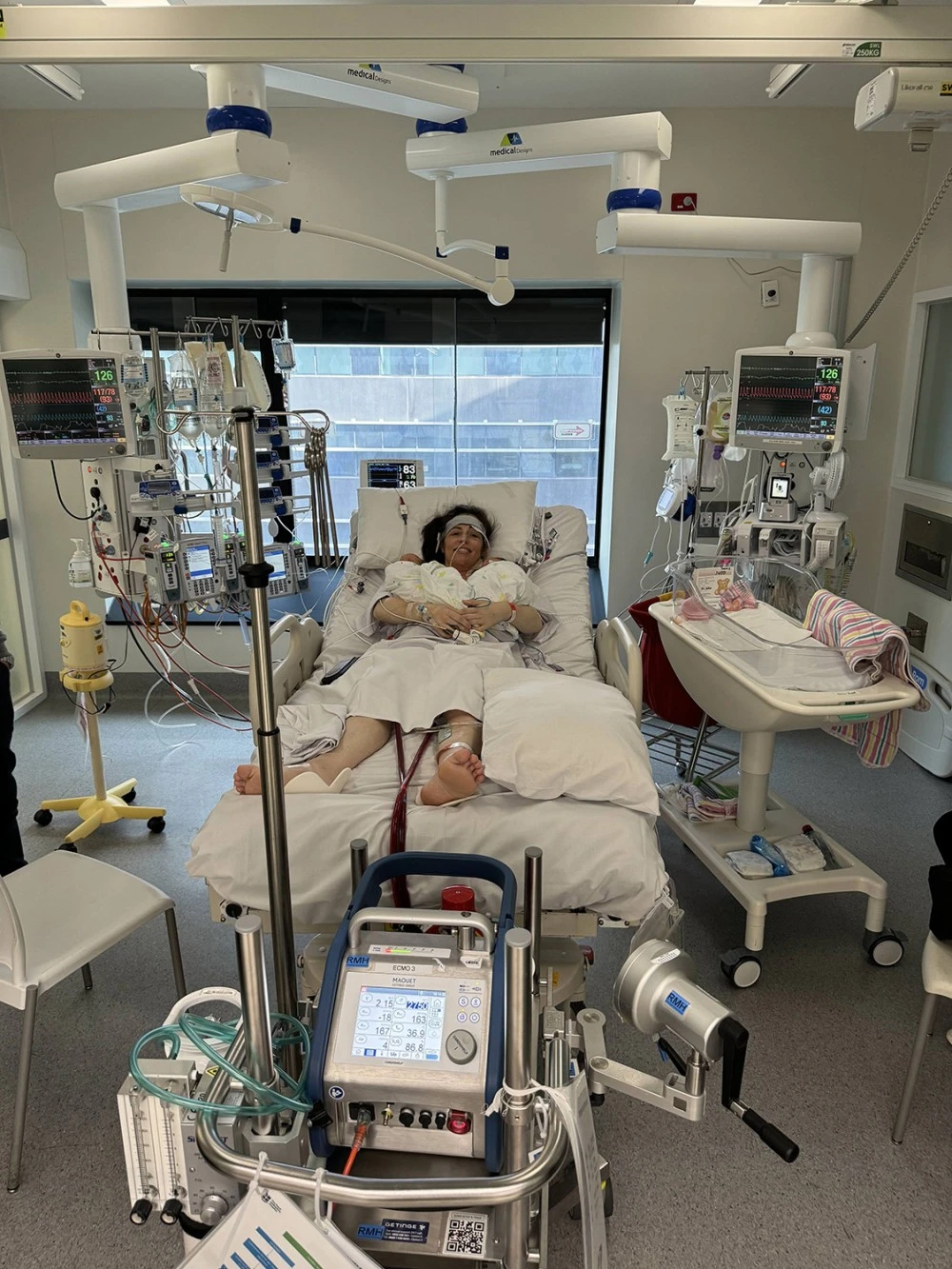 Alex on ECMO holding twins