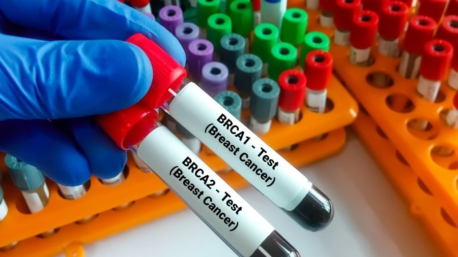 BRCA breast cancer gene test vials