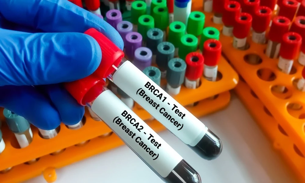 BRCA breast cancer gene test vials