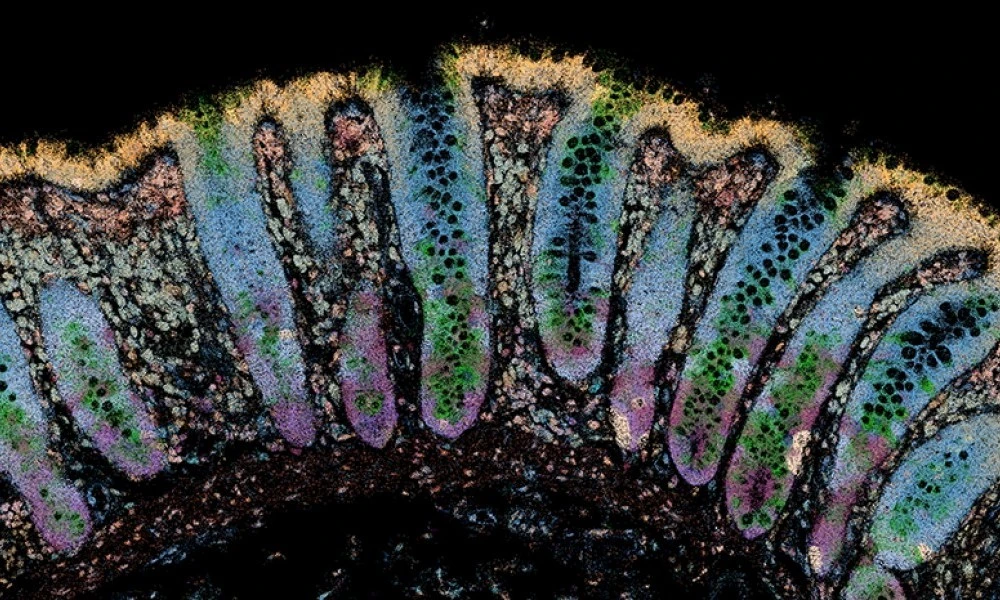 gut-tissue.jpg