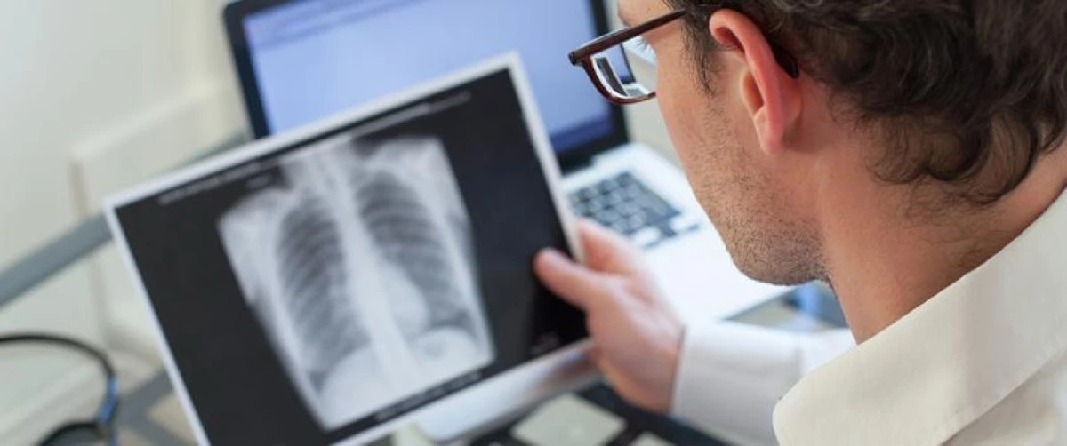 Looking at an x-ray of lungs for signs of TB