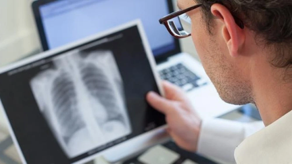 Looking at an x-ray of lungs for signs of TB