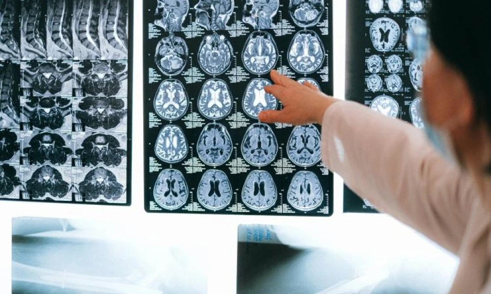 Staff looking at MRI results