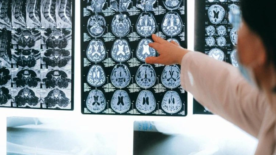 Staff looking at MRI results