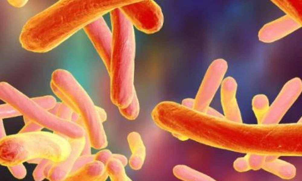 Mycobacterium tuberculosis bacteria microscopy