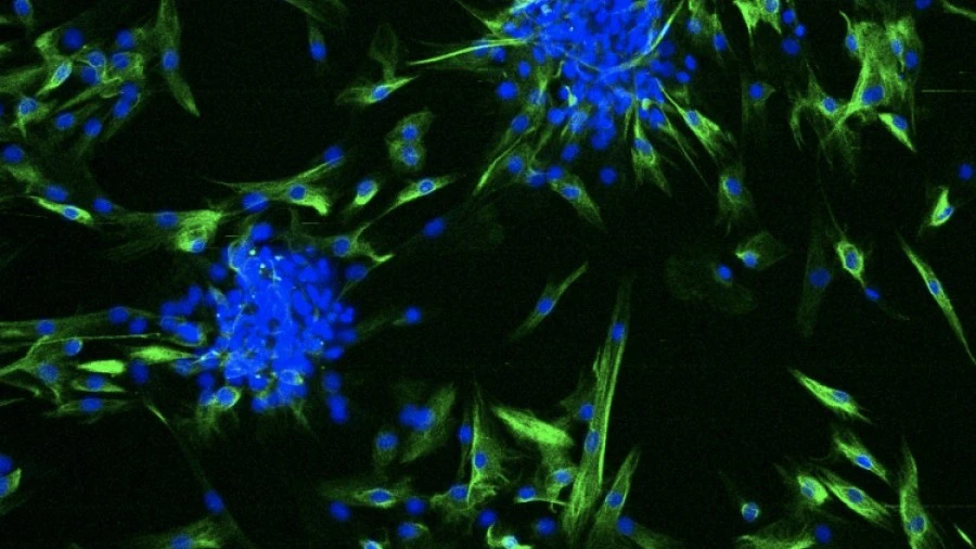 Parkinson's cell biology microscopic