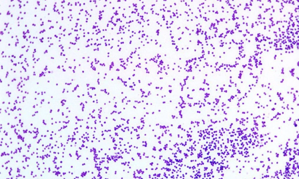 Staphylococcus aureus morphology