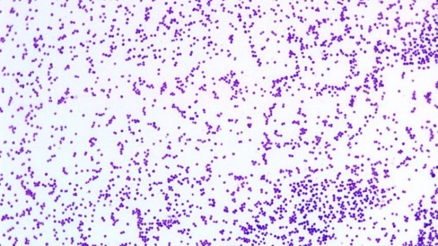Staphylococcus aureus morphology