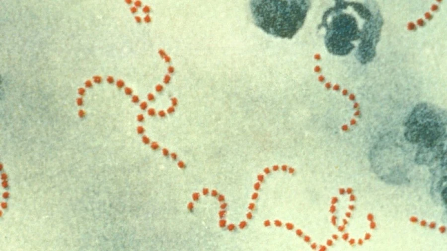 Streptococcus pyogenes