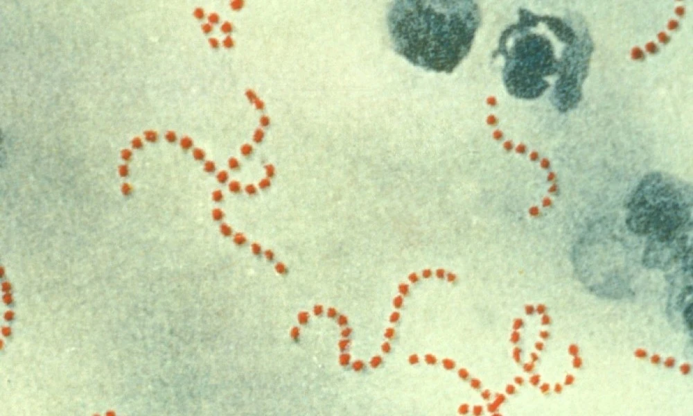 Streptococcus pyogenes
