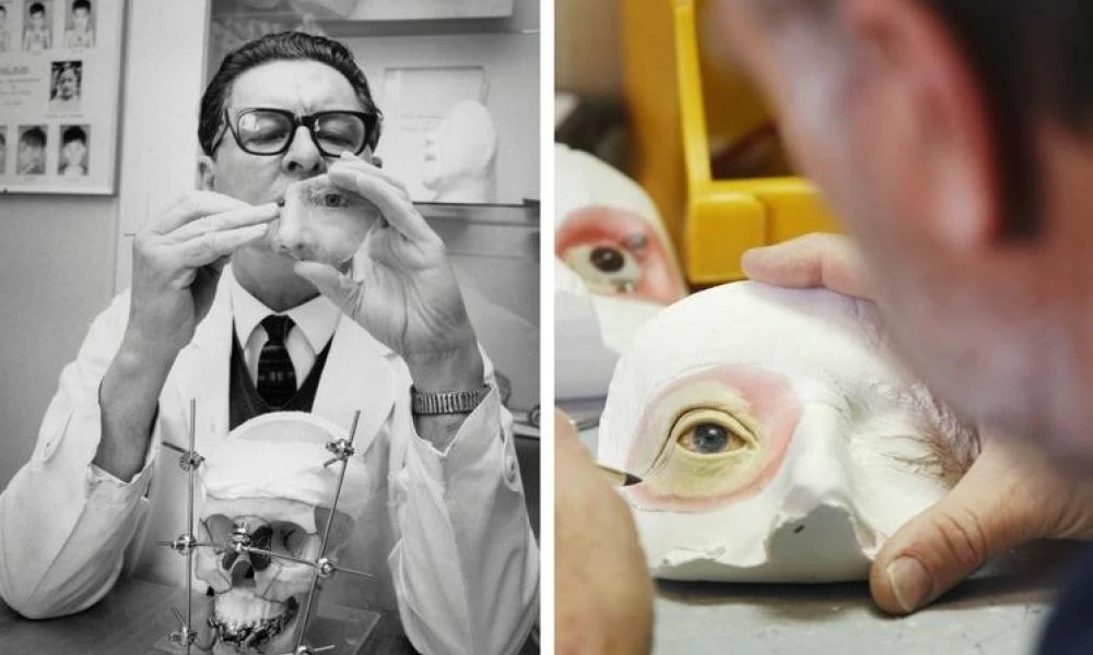 Then and now facial prosthetics