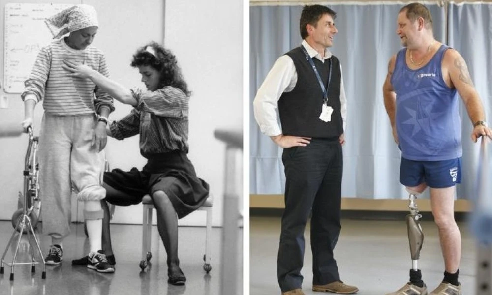 Then and now prosthetics