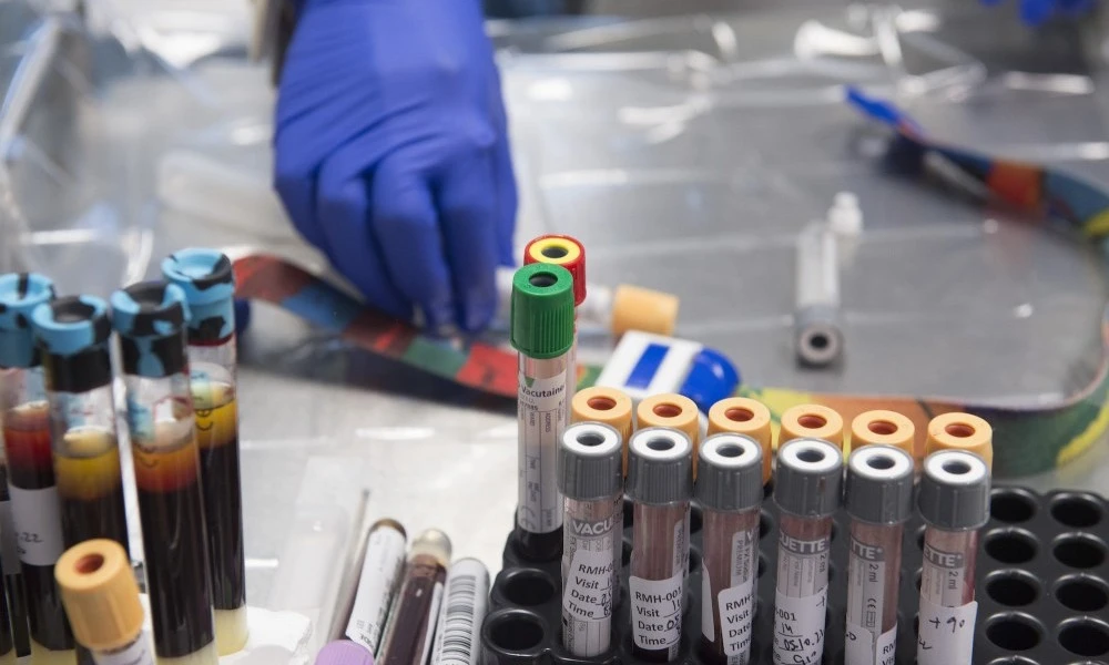 Tube of bloods in Clinical Trials Centre