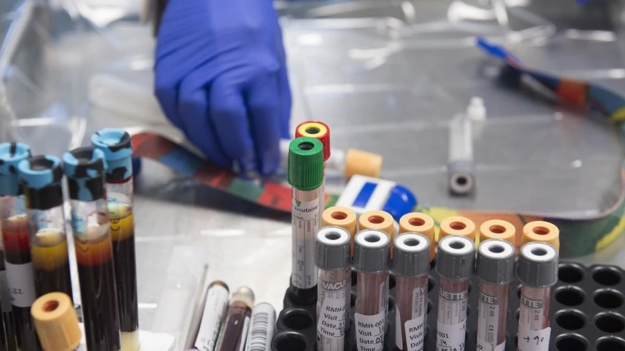 Tube of bloods in Clinical Trials Centre
