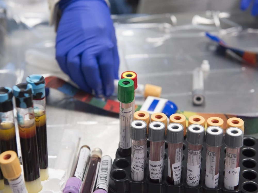 Tube of bloods in Clinical Trials Centre
