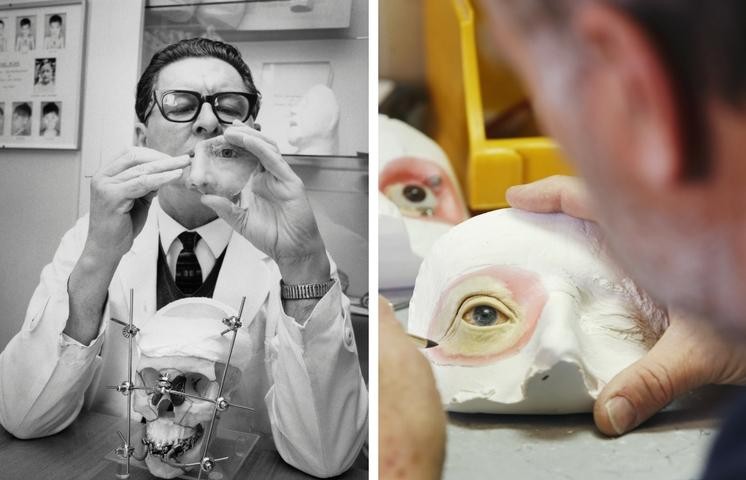 Then and now facial prosthetics