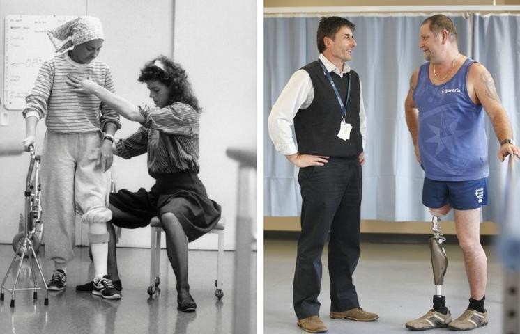 Then and now prosthetics